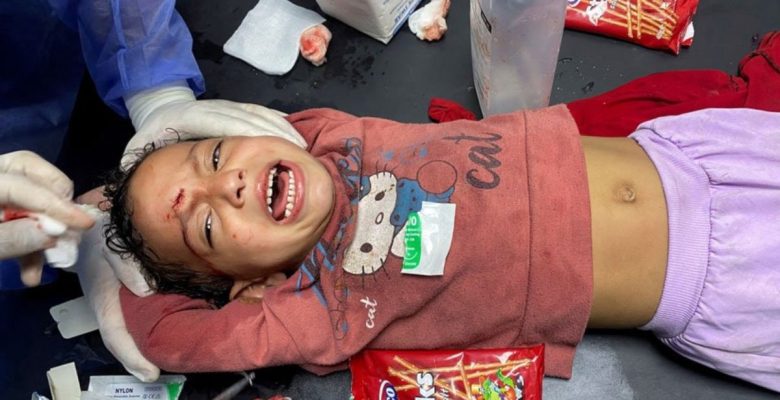 Gazze’de anestezisiz ameliyatlar… ‘Ya bu acıyı çekecekler ya da ölecekler’