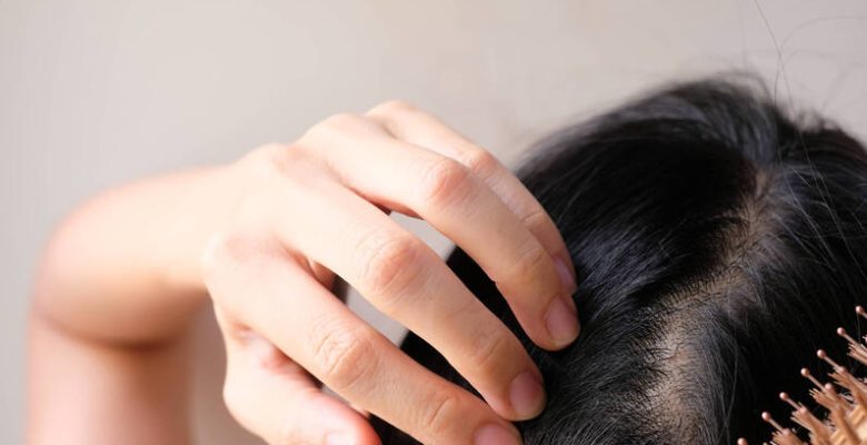 Kuru saç derisi için bakım yolları