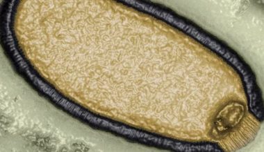 Bilim insanlarından zombi virüs uyarısı: Ölümcül yeni salgın yolda