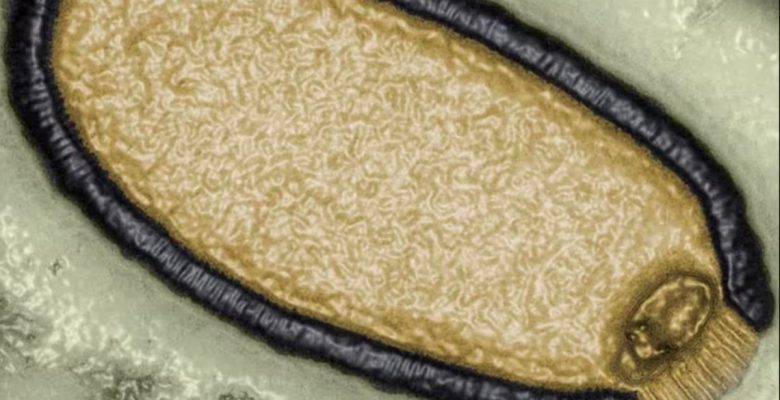 Bilim insanlarından zombi virüs uyarısı: Ölümcül yeni salgın yolda